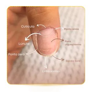 Anatomía de las Uñas